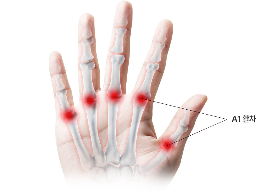 A1 활차 위치 표시